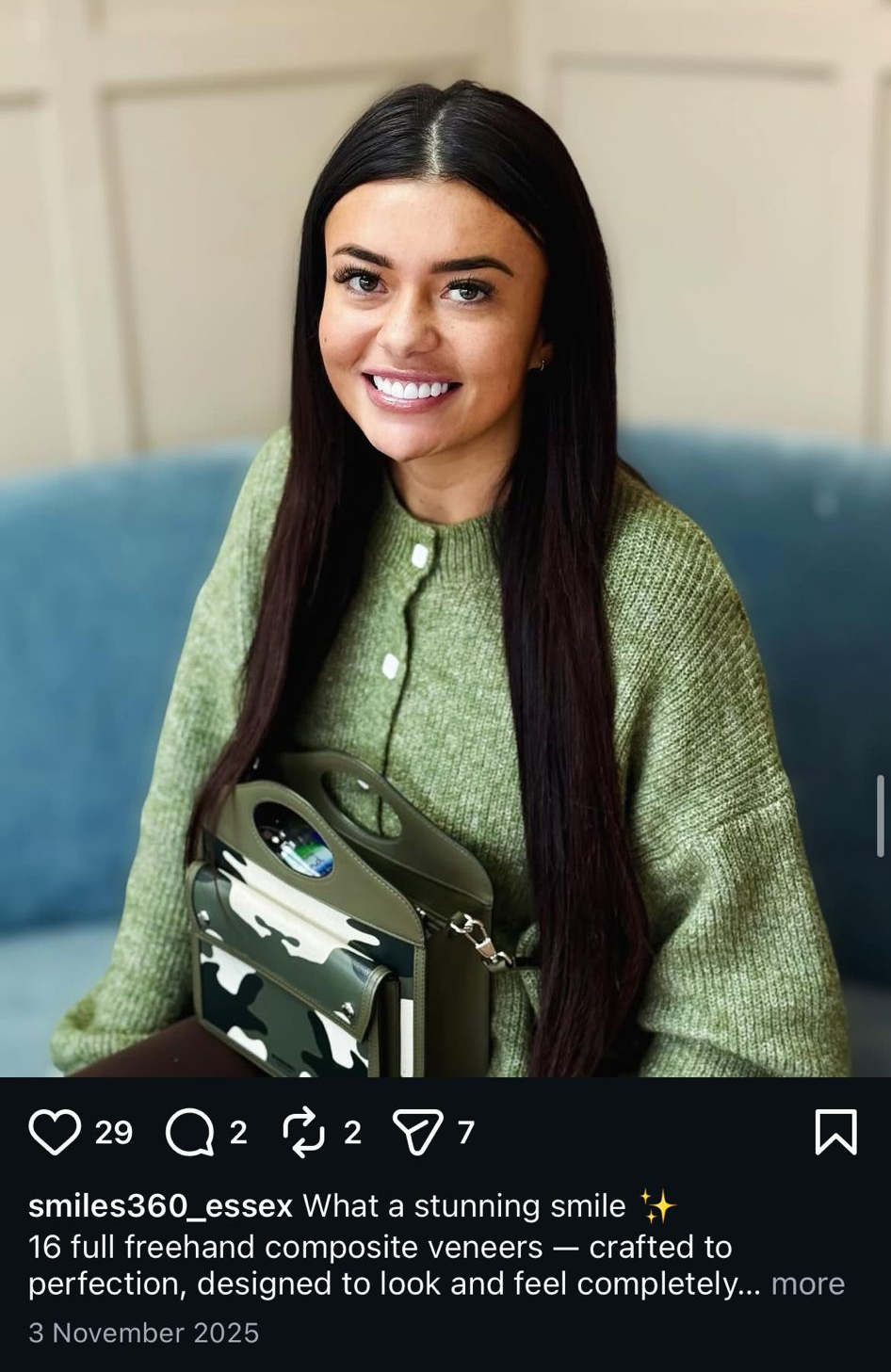 Composite bonding smile result at Smiles360 Dental Practice Hornchurch
