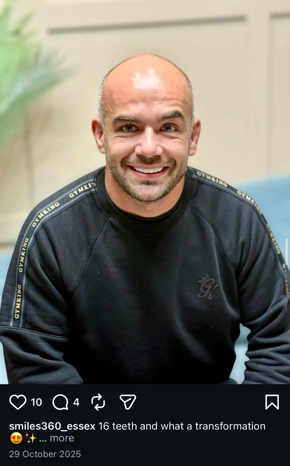 Patient composite bonding result at Smiles360 Hornchurch