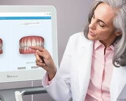 Invisalign iTero 3D Digital Scan at Smiles360 Hornchurch RM11